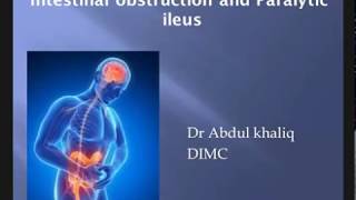 Intestinal Obstruction amp Paralytic Ileus  Surgery [upl. by Siloum810]