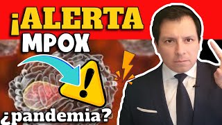 ALERTA ⚠️ ¿NUEVA PANDEMIA AMENAZA AL MUNDO ¿VIRUELA DEL MONO [upl. by Issor]