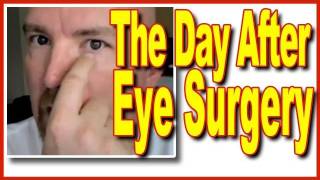 Surviving Eye Surgery  The Day After Chalazion Part 2 [upl. by Einnaffit]