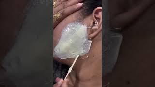 Face waxing youtubeshorts facialhair like facialhairremoval subscribe facialhairremoval [upl. by Ansilme]