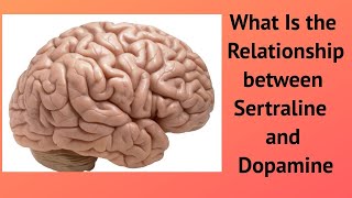 What Is the Relationship between Sertraline and Dopamine [upl. by Eittel388]