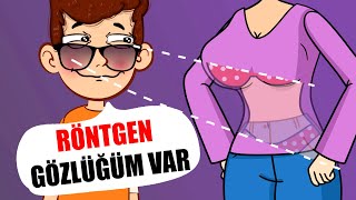 Röntgen Gözlüğüm Var  Hikayem Bitmedi [upl. by Hedley699]