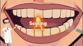 dental scaling and polishing  ASMR  dentist asmr  asmr dentist cleans your teeth [upl. by Robyn]