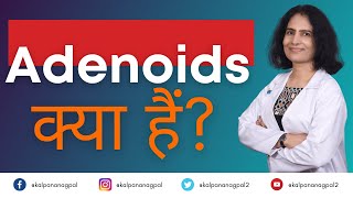 Adenoids क्या हैं ENT Surgeon I Dr Kalpana Nagpal [upl. by Adrianne]