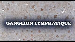 GANGLION LYMPHATIQUE profil immuno 2  HISTOLOGIE [upl. by Flight]