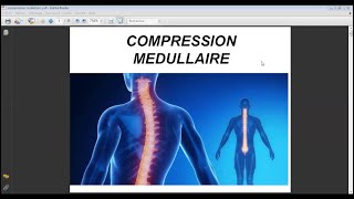 COMPRESSION MÉDULLAIRE [upl. by Mehalick]