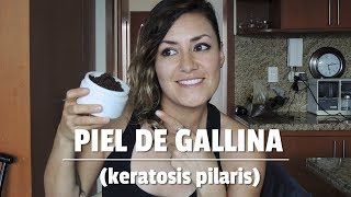 Cómo mejorar la piel de gallina keratosis pilaris [upl. by Retnuh]