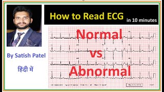 How to read an ECG normal vs abnormal ECGpna1 satishpatel [upl. by Noislla]