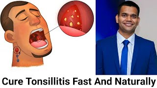 How To Cure Tonsillitis Fast And Naturally Powerful Home Remedies For Tonsil Stones That Works Fast [upl. by Edith422]