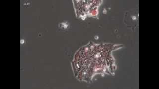 Epithelial to Mesenchymal Transition [upl. by Nnahtebazile119]