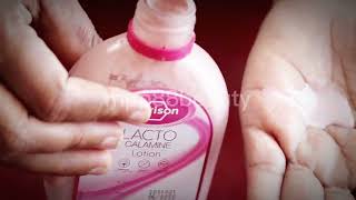 Can I use Lacto Calamine Lotion LACTO CALAMINE LOTION 100ML review [upl. by Raychel651]