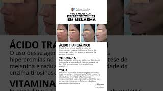 Ativos para Melasma [upl. by Radmen232]