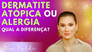 Dermatite atópica ou alergia  Dra Beatriz Franchito Baldi [upl. by Eslek]