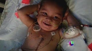 Un niño se recupera de un trasplante de cinco órganos en Miami  Noticiero Univisión [upl. by Ikkin457]