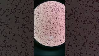 Staphylococcus under the microscope laboratory medtechstudent mls cls bacteria gramstaining [upl. by Anah]