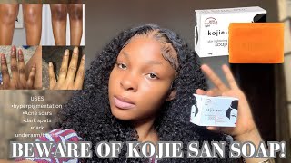 KOJIE SAN SOAP REVIEW USESBENEFITS HOW TO USE PROPERLY AND IDENTIFY THE FAKE AND ORIGINAL [upl. by Vickey175]