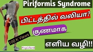 Piriformis Syndrome in TamilPiriformis Pain Relief Exercisesபிட்டத்தில் உள்ள வலிபோக எளிய வழி [upl. by Neik]