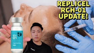 REPLICEL RCH01 HAIR LOSS TREATMENT TERMINATES LICENSE AGREEMENT WITH SHISEIDO FampK [upl. by Einor]