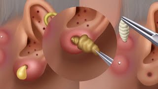 ASMR Ear cleaning and Earwax Removal  asmr animation  satisfying [upl. by Acimot]