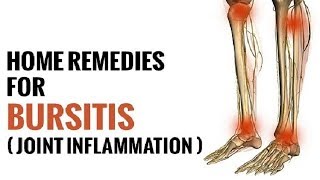 5 Remedies For Bursitis  How to Treat Bursitis  By Top 5 [upl. by Aytnahs703]