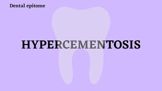 HYPERCEMENTOSIS [upl. by Tomkin]