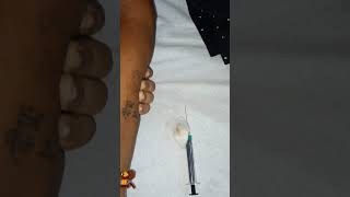 subcutaneous injection video skin test video vlog xylocaine sensitivity kaise kare full procedure [upl. by Kurtz]