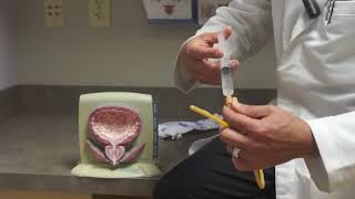 How a Bladder Catheter Works [upl. by Tenn]