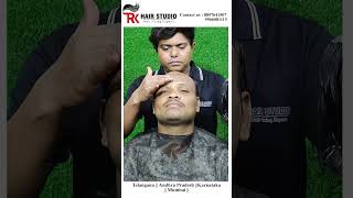 natural looking hair patch for man telangana haircare hairpatch hairstyle haircut hair [upl. by Annauj662]