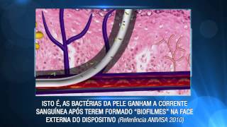 Prevenção de Infecção de Corrente Sanguínea Relacionada a Cateter [upl. by Ordisi174]