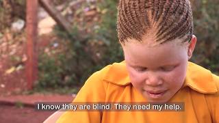 See my life experiences of people with Albinism in Africa [upl. by Alaaj]