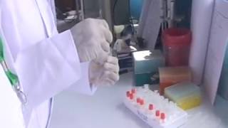 DNA extraction from dry blood spot DBS Practical 1 Dr Fowora [upl. by Euginomod]