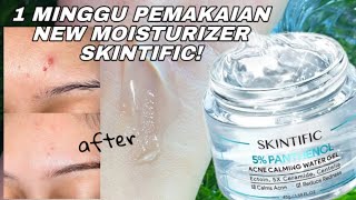 HONEST REVIEW Moisturizer Terbaru Skintific 5 Panthenol Acne Calming Water Gel [upl. by Aiduan]