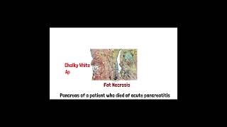 Cell Injury Pathology  Reversible and Irreversible Cell Injury  Part 2 doctor mbbs anatomy [upl. by Cori]