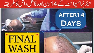 Final wash after hair transplant on day 14 [upl. by Shaffer]