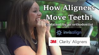 How aligners like Invisalign move teeth  Time lapse explained [upl. by Lemay]