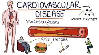 Understanding Cardiovascular Disease Visual Explanation for Students [upl. by Earaj]