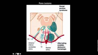 Where is the lesion Part 3 [upl. by Lattie149]