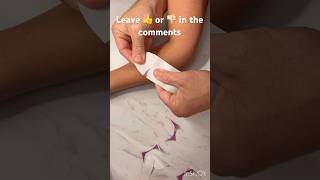 Kinesiology tape treatment for tennis elbow tenniselbow [upl. by Neirol]