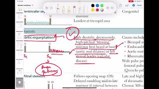 Aortic Regurgitation murmur cardiology 39  First Aid USMLE Step 1 in UrduHindi [upl. by Ojybbob]