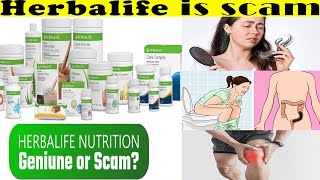 Dhruv Rathee Exposes Herbalife [upl. by Grannias66]