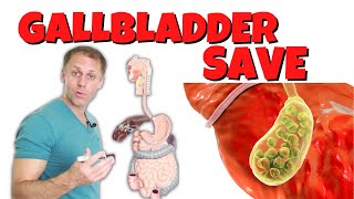 How to Save a Gallbladder and Get Rid of Gallstones [upl. by Bowie]