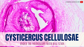 Cysticercus cellulosae under the microscope with Haematoxylin and Eosin HampE stain [upl. by Alyhs]