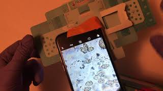 Using the foldscope to collect parasite egg images a demo [upl. by Sivolc]