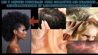 7 ASTUCES NATURELLES POUR COMBATTRE LES PELLICULES ET LES DEMANGEAISONS DU CUIR CHEVELURE [upl. by Nolubez]