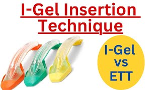 IGel Insertion Technique  IGel vs Endotracheal Tube [upl. by Nwahsauq]