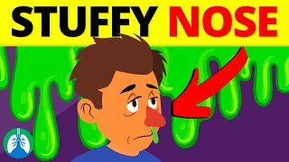 7 Ways to Clear a Stuffy Nose Nose Unblocking Techniques [upl. by Ilyk]