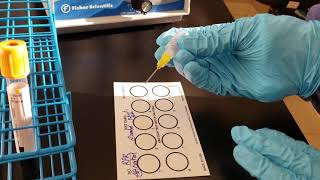 Microbiology Rapid Plasma Reagin RPR Test [upl. by Enelegna]