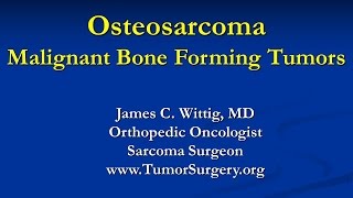 Orthopedic Oncology Course  Malignant Bone Forming Tumors Osteosarcoma  Lecture 4 [upl. by Rothwell199]