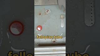 Fallopian tube biopsy 🧐 sample  sterilization [upl. by Ytsrik89]