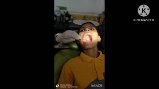 Tooth restorationfunnyDental filling dentist oralhealth funny [upl. by Sutsuj517]